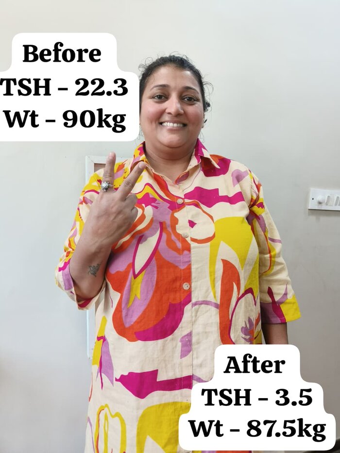 Patient thyroid improvement at Madhavbaug Rambaug